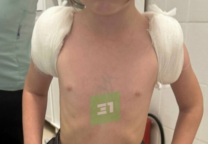 � ������������� �� ����� ���������� ������ �������