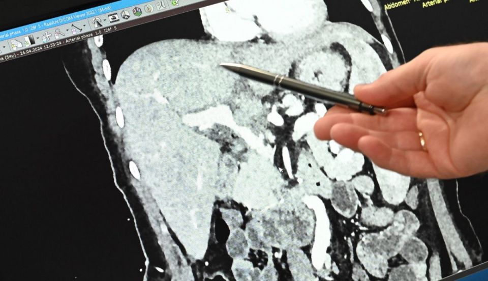 ��� � ����������� ������� ���������� ������� �� ����: ���� �� ����������� �� ����������